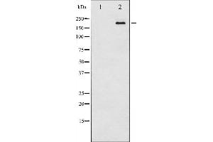 Western blot analysis of Tuberin/TSC2 expression in 293 whole cell lysates,The lane on the left is treated with the antigen-specific peptide. (Tuberin 抗体  (Internal Region))