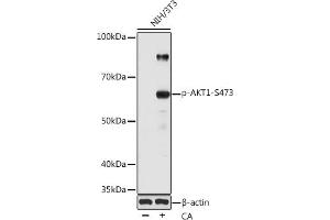 Western blot analysis of extracts of various cell lines, using Phospho--S473 pAb (ABIN1513328, ABIN5664973, ABIN5664975 and ABIN6225474) at 1:1000 dilution. (AKT1 抗体  (pSer473))