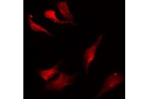 Immunofluorescence (fixed cells) (IF/ICC) image for anti-Potassium Intermediate/small Conductance Calcium-Activated Channel, Subfamily N, Member 4 (KCNN4) (C-Term) antibody (ABIN6258249)