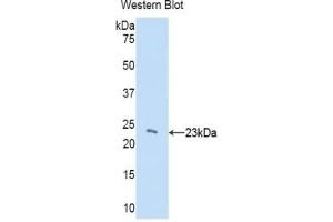 Detection of recombinant CBX3 using Polyclonal Antibody to Chromobox Homolog 3 (CBX3) (CBX3 抗体  (AA 1-183))