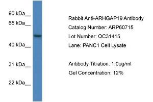 Western Blotting (WB) image for anti-rho GTPase Activating Protein 19 (ARHGAP19) (C-Term) antibody (ABIN2788550) (ARHGAP19 抗体  (C-Term))