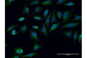 Immunofluorescence of monoclonal antibody to TPR on HeLa cell. (TPR 抗体  (AA 1-98))
