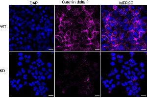 Immunocytochemical staining of HeLa cells using Catenin delta 1 antibody (ABIN7797933), 1:1,000), Top panel: wild-type (WT), Bottom panal: Catenin delta 1 shRNA knockdown (KD).
