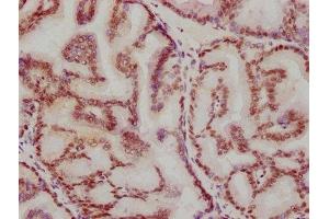 IHC image of ABIN7127346 diluted at 1:115.