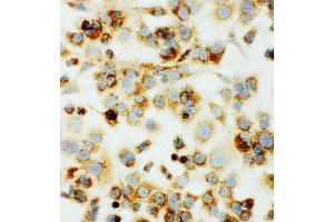 Immunohistochemistry (IHC) image for anti-Cytochrome C Oxidase Subunit I (COX1) (AA 2-14), (N-Term) antibody (ABIN3042632)