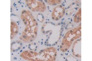Used in DAB staining on fromalin fixed paraffin- embedded Kidney tissue (POMP 抗体  (AA 1-141))
