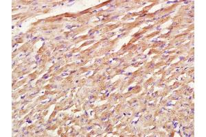 Paraformaldehyde-fixed, paraffin embedded rat heart; Antigen retrieval by boiling in sodium citrate buffer (pH6. (COX1 抗体  (AA 401-500))