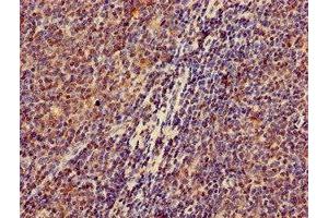 Immunohistochemistry of paraffin-embedded human lymph node tissue using ABIN7176612 at dilution of 1:100 (ZKSCAN3 抗体  (AA 8-275))