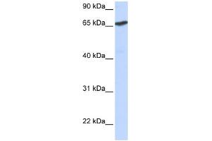 WB Suggested Anti-L3MBTL Antibody Titration:  0. (L3MBTL1 抗体  (N-Term))