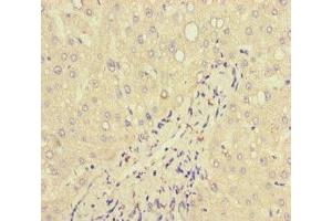 Immunohistochemistry of paraffin-embedded human liver tissue using ABIN7157839 at dilution of 1:100 (Lactoferrin 抗体  (AA 156-413))