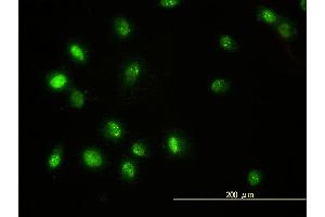 Immunofluorescence of monoclonal antibody to STAT5B on HeLa cell. (STAT5B 抗体  (AA 1-390))