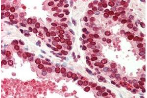 anti-Barrier To Autointegration Factor 1 (BANF1) (C-Term) antibody