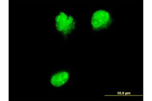 Immunofluorescence of monoclonal antibody to NUP62 on HeLa cell. (NUP62 抗体  (AA 423-522))