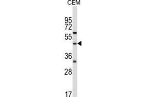 Western Blotting (WB) image for anti-Cbl proto-oncogene C (CBLC) antibody (ABIN2996831) (CBLC 抗体)