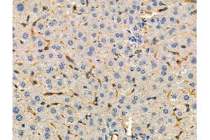 ABIN6259757 and ABIN6276478 at 1/100 staining Mouse liver tissue by IHC-P.
