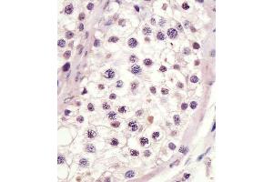 staining MLL3 in human testis tissue sections by Immunohistochemistry (IHC-P - paraformaldehyde-fixed, paraffin-embedded sections). (MLL3 抗体  (C-Term))