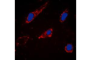Immunofluorescence (IF) image for anti-Cytochrome P450, Family 2, Subfamily C, Polypeptide 19 (CYP2C19) (Center) antibody (ABIN7301582)