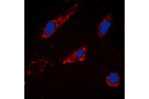 Immunofluorescent analysis of Cytochrome P450 2C19 staining in Hela cells. (CYP2C19 抗体  (Center))