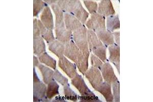 VILL Antibody (Center) immunohistochemistry analysis in formalin fixed and paraffin embedded human skeletal muscle followed by peroxidase conjugation of the secondary antibody and DAB staining. (VILL 抗体  (Middle Region))
