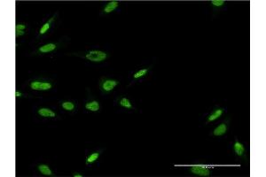 Immunofluorescence of monoclonal antibody to LHX6 on HeLa cell. (LHX6 抗体  (AA 274-363))