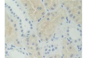 IHC-P analysis of Human Kidney Tissue, with DAB staining. (AHCY 抗体  (AA 2-432))