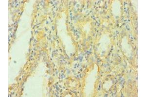 Immunohistochemistry of paraffin-embedded human kidney tissue using ABIN7159700 at dilution of 1:100 (MCPH1 抗体  (AA 536-835))