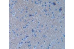 IHC-P analysis of Human Tissue, with DAB staining. (FGF3 抗体  (AA 154-232))