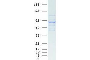 Western Blotting (WB) image for Thyroid Hormone Receptor, alpha (THRA) (Transcript Variant 2) protein (Myc-DYKDDDDK Tag) (ABIN2733595)