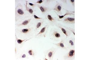 IHC analysis of MAD1 using anti-MAD1 antibody (ABIN3043387).