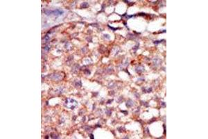Image no. 2 for anti-Receptor-Interacting Serine-threonine Kinase 4 (RIPK4) (C-Term) antibody (ABIN360126) (RIPK4 抗体  (C-Term))