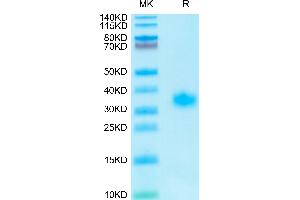 ADIPOQ Protein (AA 19-244) (His tag)