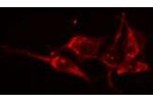 ABIN6275048 staining HuvEc cells by IF/ICC. (GBA3 抗体  (Internal Region))