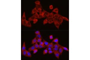 Immunofluorescence analysis of HeLa cells using SEC61 Rabbit pAb (1614) at dilution of 1:350 (40x lens). (SEC61A1 抗体  (AA 310-420))