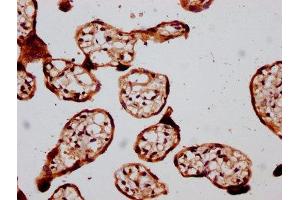 IHC image of ABIN7172786 diluted at 1:400 and staining in paraffin-embedded human placenta tissue performed on a Leica BondTM system. (GATAD2B 抗体  (AA 58-146))