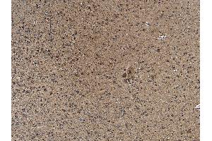 Immunohistochemistry (IHC) image for anti-Sodium Channel, Voltage-Gated, Type V, alpha Subunit (SCN5A) (Internal Region) antibody (ABIN185467)
