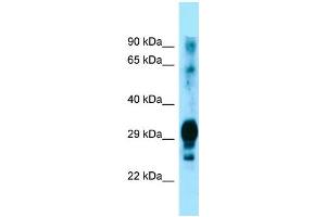 Western Blotting (WB) image for anti-Glycoprotein M6A (GPM6A) (C-Term) antibody (ABIN2790022) (GPM6A 抗体  (C-Term))