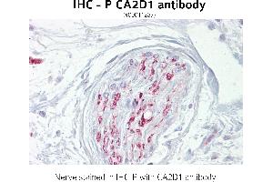 Image no. 1 for anti-Calcium Channel, Voltage-Dependent, alpha 2/delta Subunit 1 (CACNA2D1) (N-Term) antibody (ABIN347205) (CACNA2D1 抗体  (N-Term))