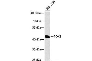 Western blot analysis of extracts of SH-SY5Y cells using PDK3 Polyclonal Antibody at dilution of 1:1000. (PDK3 抗体)