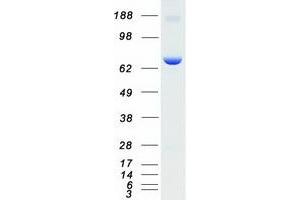 Validation with Western Blot