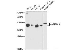 Western blot analysis of extracts of various cell lines using KIR2DL4 Polyclonal Antibody at dilution of 1:3000. (KIR2DL4/CD158d 抗体)