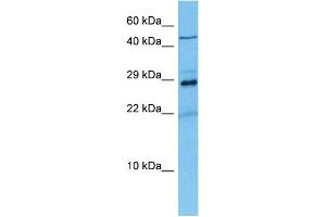 Host:  Mouse  Target Name:  KCNIP2  Sample Tissue:  Mouse Liver  Antibody Dilution:  1ug/ml (KCNIP2 抗体  (N-Term))