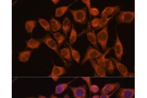 Immunofluorescence analysis of HeLa cells using UBQLNL Polyclonal Antibody at dilution of 1:100. (UBQLNL 抗体)