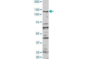 PKN1 MaxPab rabbit polyclonal antibody. (PKN1 抗体  (AA 1-942))