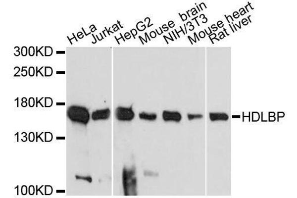 HDLBP antibody  (AA 1035-1268)