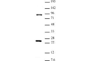Suz12 antibody (pAb) tested by Western blot. (SUZ12 抗体  (C-Term))