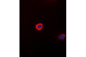 Immunofluorescent analysis of Connexin 43 staining in HeLa cells. (Connexin 43/GJA1 抗体  (C-Term))