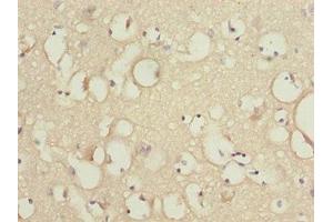 Immunohistochemistry of paraffin-embedded human brain tissue using ABIN7157257 at dilution of 1:100 (KBTBD7 抗体  (AA 475-684))
