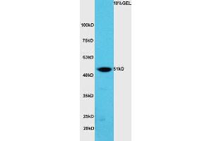 Lane 1:A549 cell lysates probed with Rabbit Anti-hnRNP K Polyclonal Antibody, Unconjugated (ABIN706571) at 1:300 overnight at 4 °C. (HNRNPK 抗体  (AA 201-300))