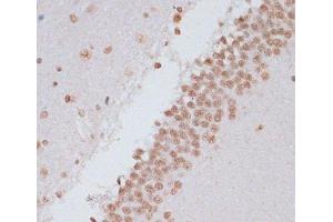 Immunohistochemistry of paraffin-embedded Rat brain using Phospho-Stat3(Y705) Polyclonal Antibody at dilution of 1:100 (40x lens). (STAT3 抗体  (pTyr705))