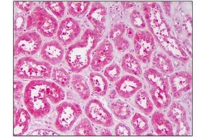 Human Kidney: Formalin-Fixed, Paraffin-Embedded (FFPE) (TNK2 抗体  (AA 278-289))